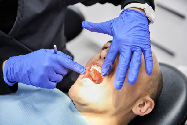 Best Emergency Tooth Extraction in Cumberland, WI